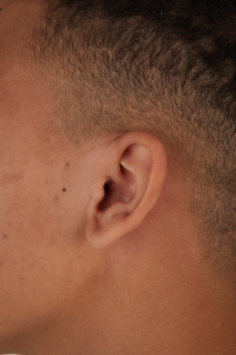 Photos of Cary Stanley ear 0001.jpg